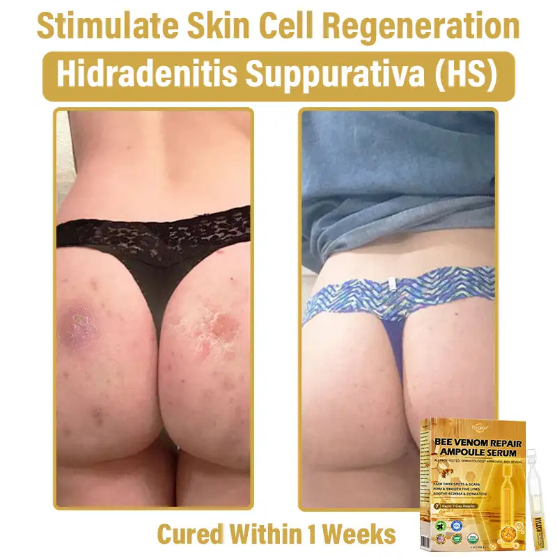 Dyceco® Bee Venom Skin Repair Ampoule Serum 9 Dyceco® Bee Venom Skin Repair Ampoule Serum - Image 9