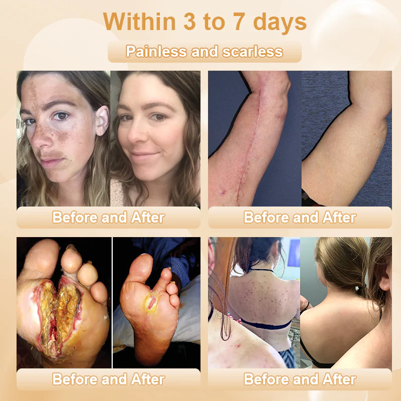 JORONDY® Bee Bright Kolirin Advanced Cream 6 JORONDY® Bee Bright Kolirin Advanced Cream