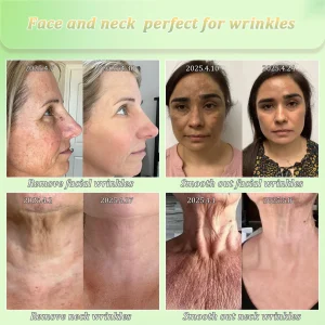 Jorondy® Skin Firming Cream 17 Jorondy® Skin Firming Cream