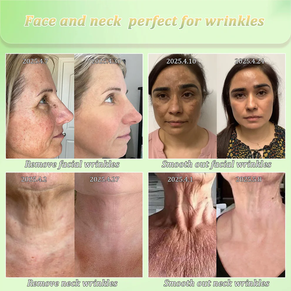 Jorondy® Skin Firming Cream 3 Jorondy® Skin Firming Cream