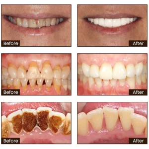 Vitamin B3 Whitening Toothpaste