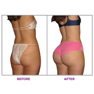 LUHAKA® Hip Plump Capric Oil