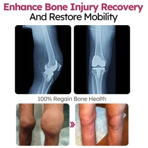 Slimoly™ Joint and Bone Recovery Cream 12 Slimoly™ Joint and Bone Recovery Cream