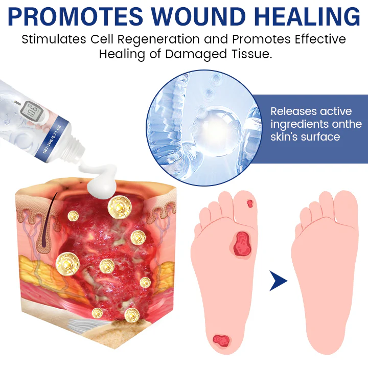 Cvreoz® SugarRelief Diabetic Treatment Cream 4 Cvreoz® SugarRelief Diabetic Treatment Cream - Image 4