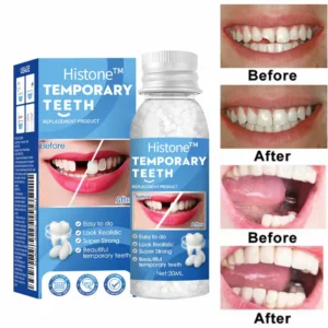 Histone™ Natural Tooth Repair Gel 11 Histone™ Natural Tooth Repair Gel