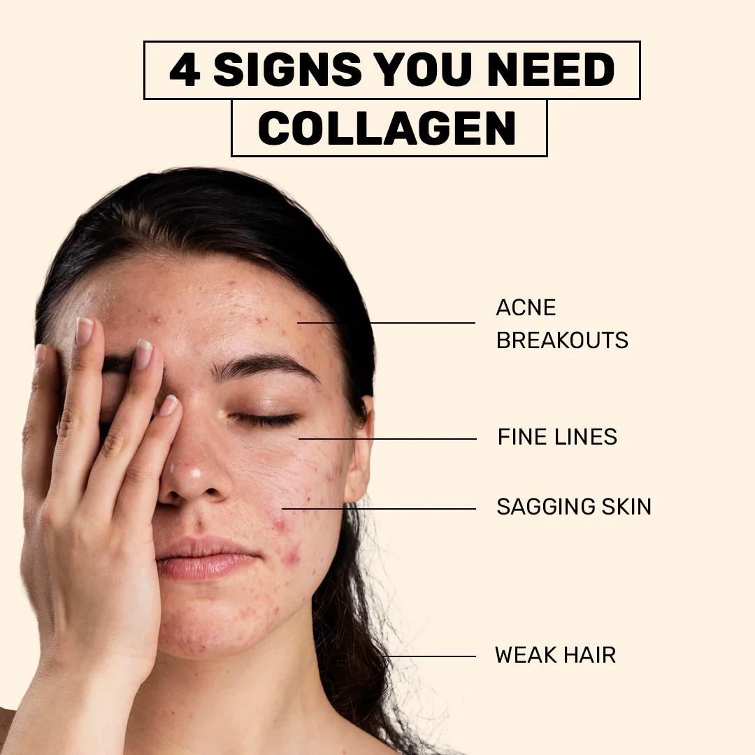 Anti-Acne Collagen 7 Anti-Acne Collagen - Image 7