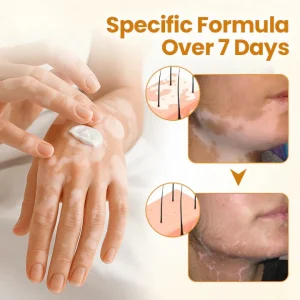 Newyuo® VitiCalm Bee Venom Cream 16 Newyuo® VitiCalm Bee Venom Cream