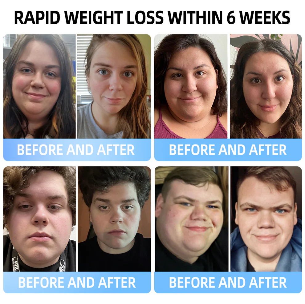 Croaie® NIDDK-Tirzepatide & Matrixyl 3000 Nano Microneedle Patch 6 Croaie® NIDDK-Tirzepatide & Matrixyl 3000 Nano Microneedle Patch