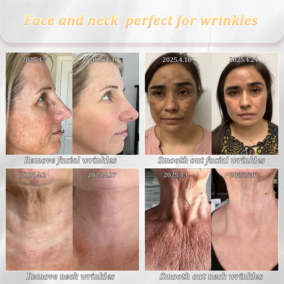 Jorondy® Erase Sagging Skin – The Ancient Herbal Formula Clinically Proven to Firm in Just Weeks 3 Jorondy® Erase Sagging Skin – The Ancient Herbal Formula Clinically Proven to Firm in Just Weeks