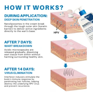 Oveallgo® NanoLipo HPV Genital Warts Eraser Cream Ultra 9 Oveallgo® NanoLipo HPV Genital Warts Eraser Cream Ultra