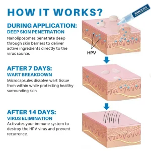 Oveallgo® NANOLIPO GENITAL WARTS CLINICAL AMPOULES 7 Oveallgo® NANOLIPO GENITAL WARTS CLINICAL AMPOULES