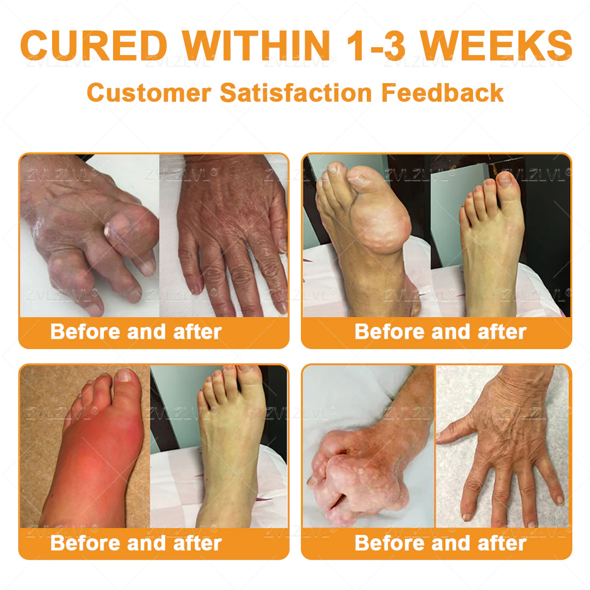 ZVLZVL® Bee Venom Pain-Relief Bone Healing Cream 3 ZVLZVL® Bee Venom Pain-Relief Bone Healing Cream - Image 3