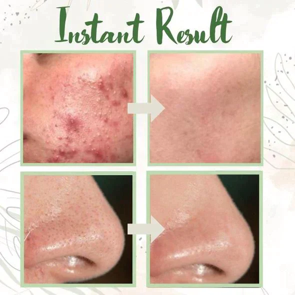 Green Tea Deep Cleansing Mask 10 Green Tea Deep Cleansing Mask - Image 10