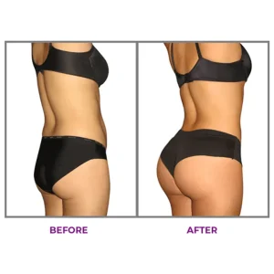 LUHAKA® Hip Plump Capric Oil
