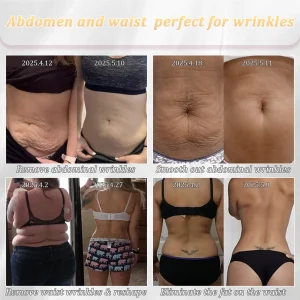 Jorondy® Erase Sagging Skin – The Ancient Herbal Formula Clinically Proven to Firm in Just Weeks 17 Jorondy® Erase Sagging Skin – The Ancient Herbal Formula Clinically Proven to Firm in Just Weeks