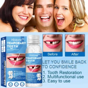 Histone™ Natural Tooth Repair Gel 10 Histone™ Natural Tooth Repair Gel