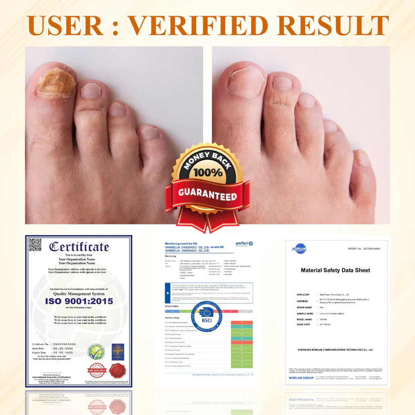 BBOJI® Fungiclear Bee Therapy Nail Spray 4 BBOJI® Fungiclear Bee Therapy Nail Spray - Image 4