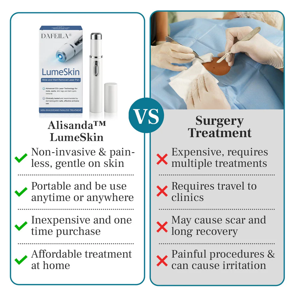 Alisanda™ LumeSkin Mole and Wart Removal Laser Pen 8 Alisanda™ LumeSkin Mole and Wart Removal Laser Pen