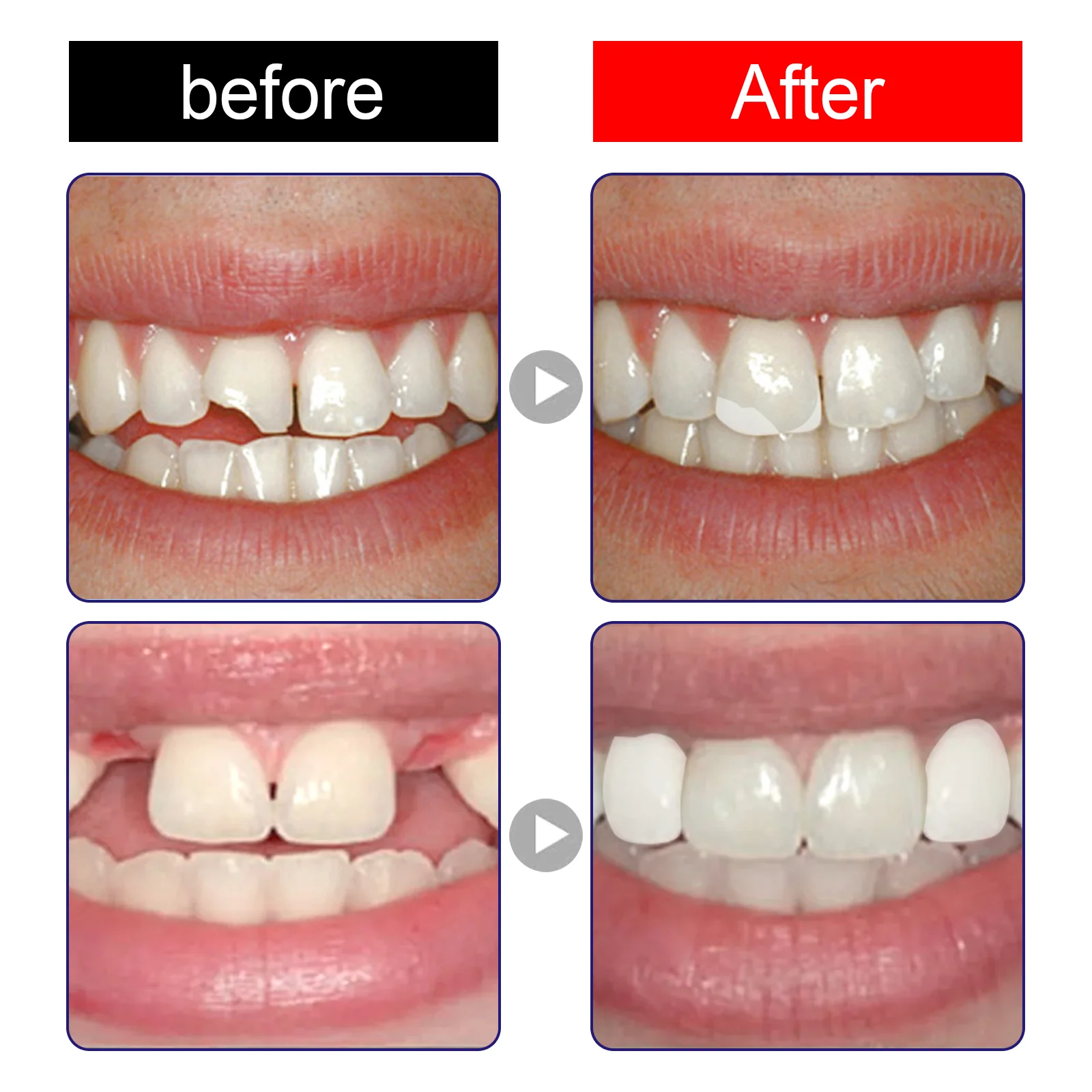 Histone™ Natural Tooth Repair Gel 7 Histone™ Natural Tooth Repair Gel - Image 7