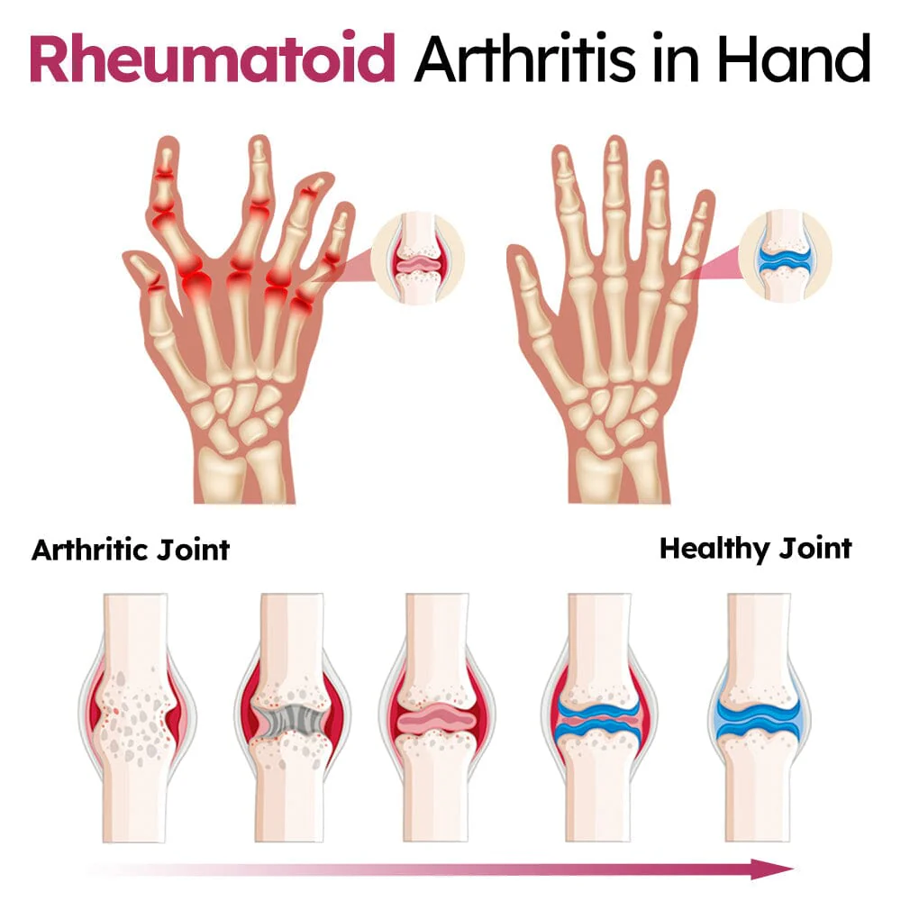 Slimoly™ Joint and Bone Recovery Cream 8 Slimoly™ Joint and Bone Recovery Cream - Image 8