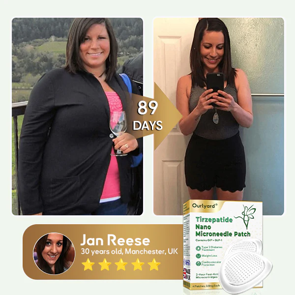 Ourlyard® Tirzepatide Nano Microneedle Patch 3 Ourlyard® Tirzepatide Nano Microneedle Patch