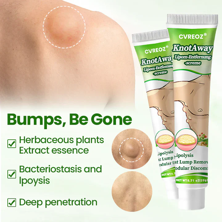 Cvreoz® KnotAway Lipoma Removal Cream 2 Cvreoz® KnotAway Lipoma Removal Cream