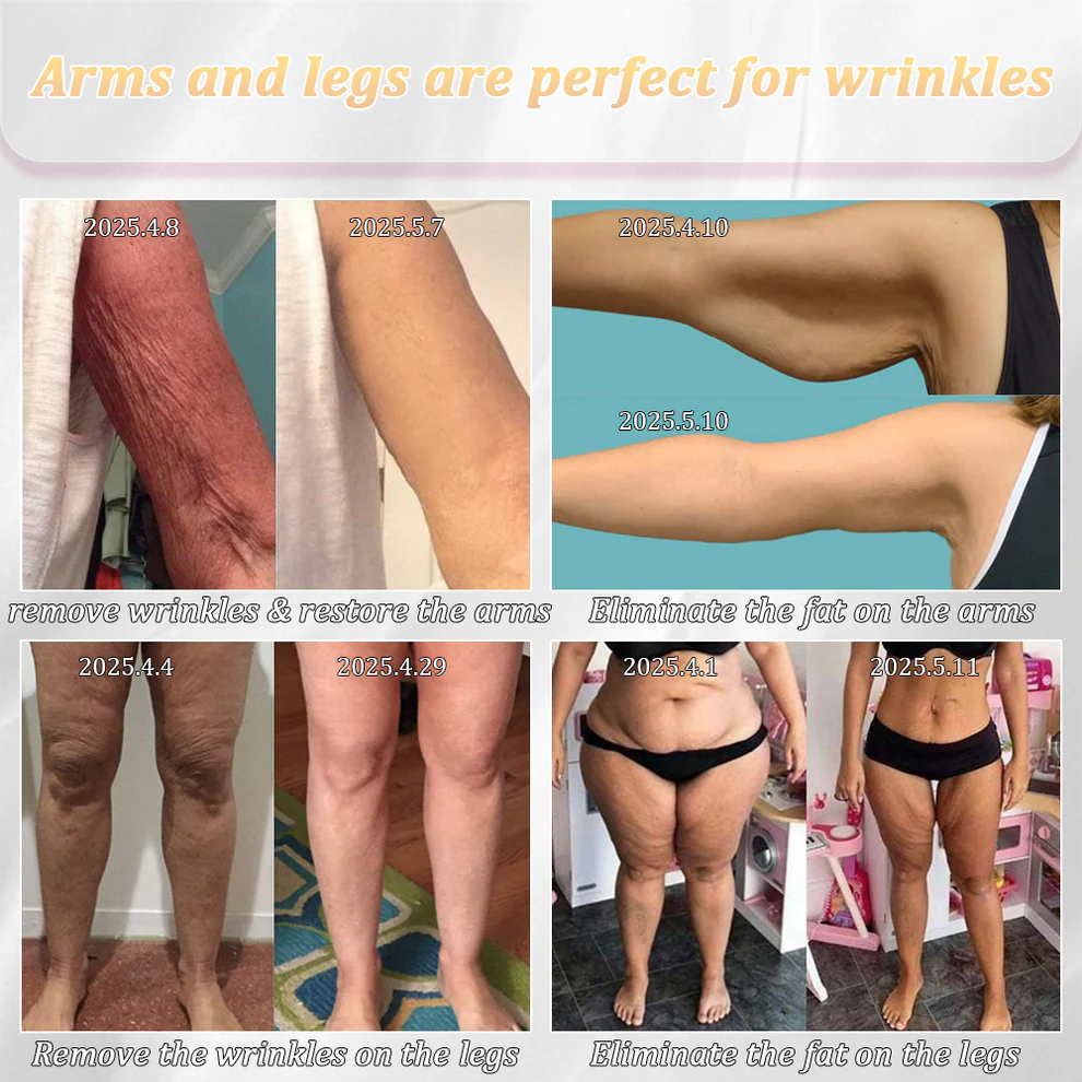 Jorondy® Erase Sagging Skin – The Ancient Herbal Formula Clinically Proven to Firm in Just Weeks 4 Jorondy® Erase Sagging Skin – The Ancient Herbal Formula Clinically Proven to Firm in Just Weeks