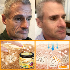 APKAPK® Bee venom Comprehensive Cream 25 APKAPK® Bee venom Comprehensive Cream