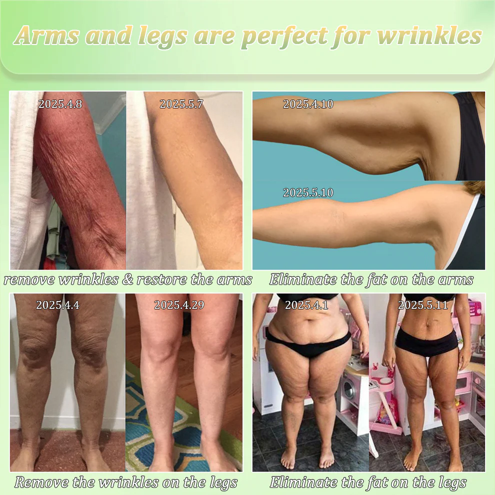 Jorondy® Skin Firming Cream 5 Jorondy® Skin Firming Cream