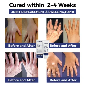 ADFIRE® Dual Action Pain Relief