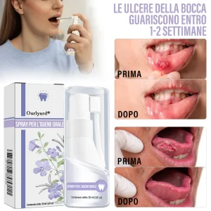 Ourlyard® Oral Care Spray with Clove Oil 9 Ourlyard® Oral Care Spray with Clove Oil