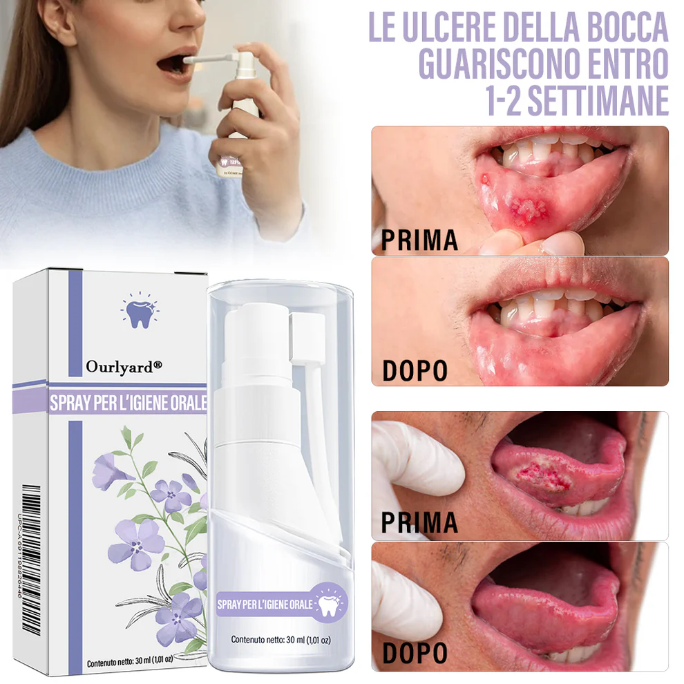 Ourlyard® Oral Care Spray with Clove Oil 3 Ourlyard® Oral Care Spray with Clove Oil