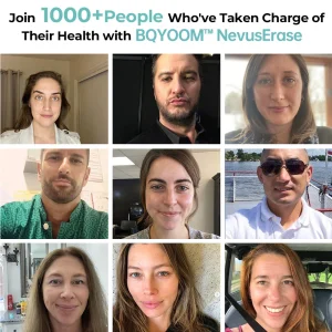 BQYOOM™ Nevus Erase Instant Mole & Spot Removal Gel 7 BQYOOM™ Nevus Erase Instant Mole & Spot Removal Gel