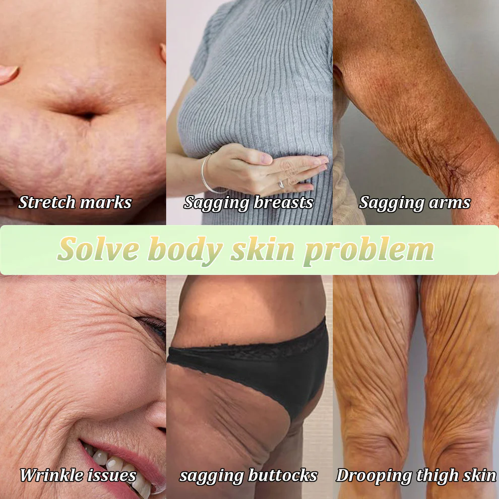 Jorondy® Skin Firming Cream 2 Jorondy® Skin Firming Cream