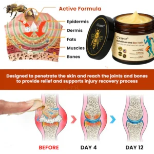 Cvreoz® Botulinum and Bee Toxin Pain Relief Bone Healing Cream