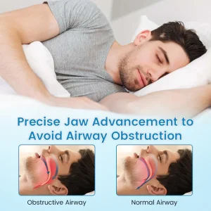 JEREMYTIS™ Adjustable Anti-Snoring Mouthpiece Universal Size 18 JEREMYTIS™ Adjustable Anti-Snoring Mouthpiece Universal Size