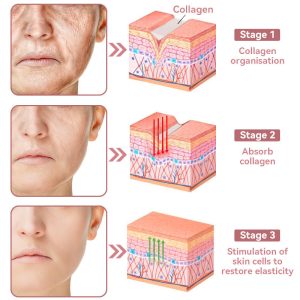 Awzlove™ Coenzyme Q10 Collagen Jelly Skin Cream 19 Coenzyme Q10 Collagen Jelly Skin Cream