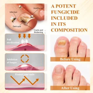 BBOJI® Fungiclear Bee Therapy Nail Spray 15 BBOJI® Fungiclear Bee Therapy Nail Spray