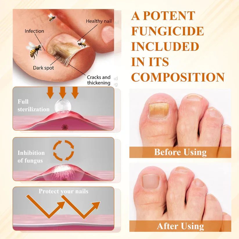 BBOJI® Fungiclear Bee Therapy Nail Spray 5 BBOJI® Fungiclear Bee Therapy Nail Spray - Image 5