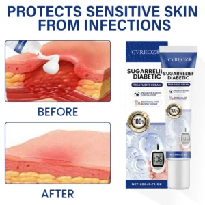 Cvreoz® SugarRelief Diabetic Treatment Cream 7 Cvreoz® SugarRelief Diabetic Treatment Cream