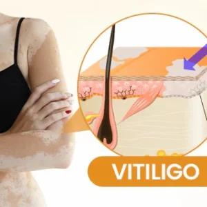 Newyuo® VitiCalm Bee Venom Cream 19 Newyuo® VitiCalm Bee Venom Cream