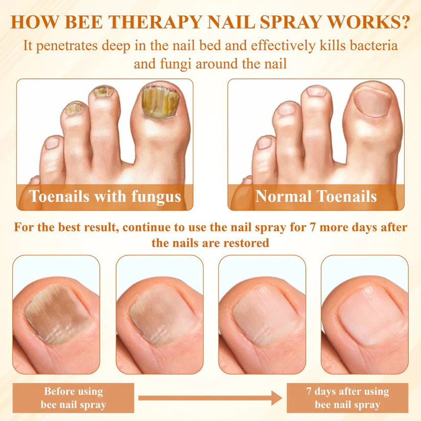 BBOJI® Fungiclear Bee Therapy Nail Spray 6 BBOJI® Fungiclear Bee Therapy Nail Spray - Image 6
