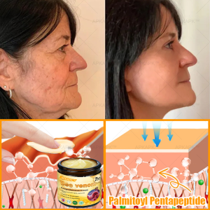 APKAPK® Bee venom Comprehensive Cream 22 APKAPK® Bee venom Comprehensive Cream