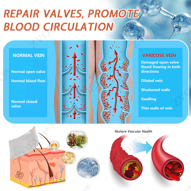 Zvoevo® Vein Ease Microneedle Care Patch 10 Zvoevo® Vein Ease Microneedle Care Patch - Image 10