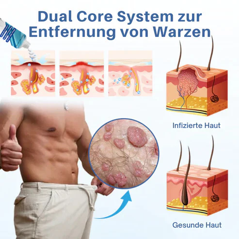 Oveallgo® GentX Wart Relief Cream 4 Oveallgo® GentX Wart Relief Cream