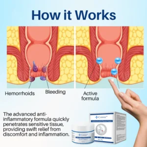 cvreoz-hemorrhoid-fissure-cream-2