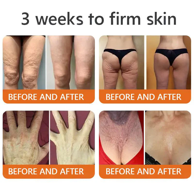 Cougex® "Dermal Gold" Botulin Bee Venom Skin Restoration Cream 10 Cougex® "Dermal Gold" Botulin Bee Venom Skin Restoration Cream