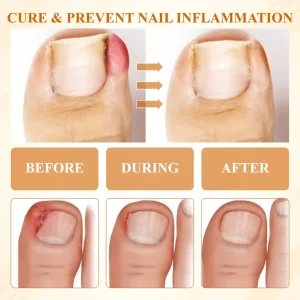 BBOJI® Fungiclear Bee Therapy Nail Spray 17 BBOJI® Fungiclear Bee Therapy Nail Spray