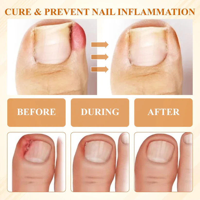 BBOJI® Fungiclear Bee Therapy Nail Spray 7 BBOJI® Fungiclear Bee Therapy Nail Spray - Image 7