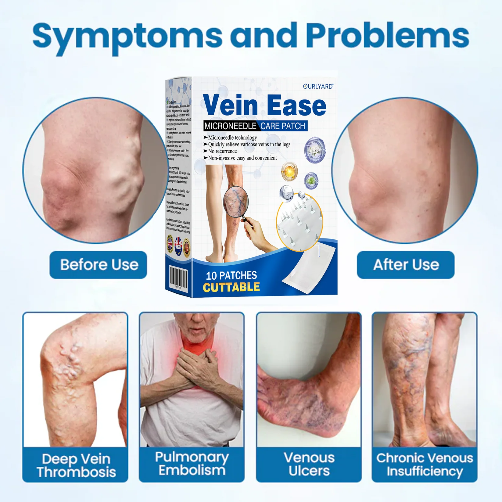 Ourlyard® Vein Ease Microneedle Care Patch - Cuttable 7 Ourlyard® Vein Ease Microneedle Care Patch - Cuttable - Image 7